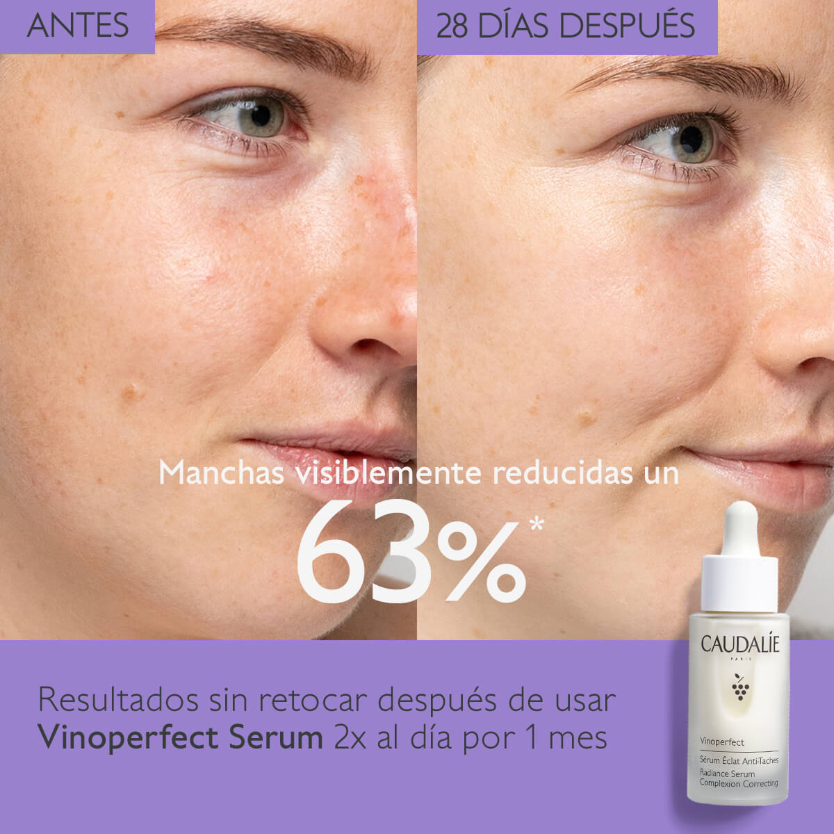 VINOPERFECT SERUM RESPLANDOR ANTI-MANCHAS